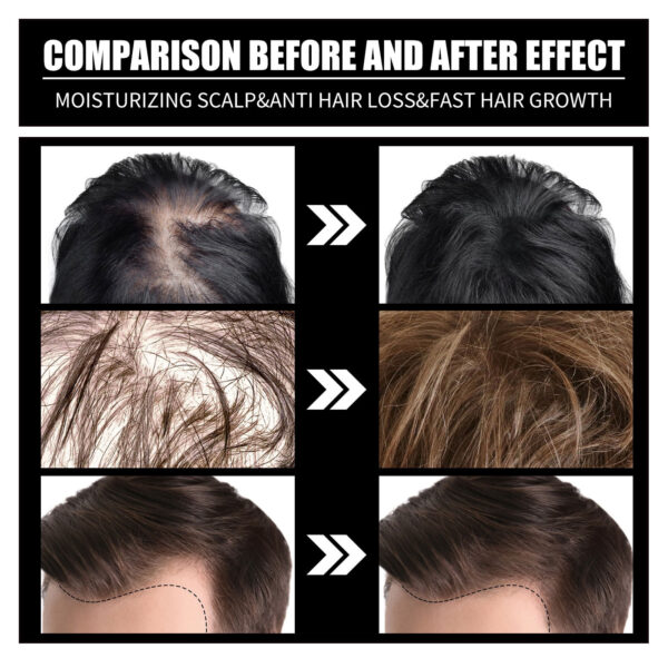 RESEARCH Liquid Biotin & Collagen Hair Growth Drops  - Biotin And Liquid Collagen Supplement For Men & Women - Glowing Skin Support, Healthy Hair & Nail Growth - Image 3